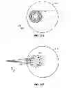 Fig. 26 - Charged particle accelerator magnet apparatus and method of use thereof