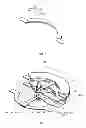 Fig. 08 - Phase array antenna having a movable phase shifting element and a dielectric element for changing the relative dielectric constant