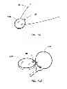 Fig. 35 - User gesture input to wearable electronic device involving outward-facing sensor of device