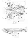 Fig. 10 - And method of operation of micro-milliactuators and micro-microactuators