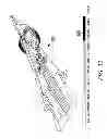Fig. 18 - And method of operation of micro-milliactuators and micro-microactuators