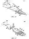 Fig. 27 - And method of operation of micro-milliactuators and micro-microactuators