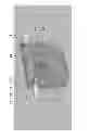 Fig. 08 - Rotating wavelength conversion element