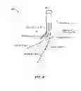 Fig. 06 - STEERABLE TOWED SIGNAL SOURCE
