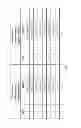 Fig. 06 - Downlink control signalling for indication of interfering layers