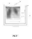 Fig. 07 - Method for x-ray dose tracking