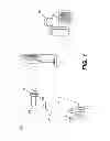 Fig. 02 - Hybrid dual energy imaging and bone suppression processing