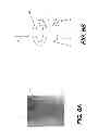 Fig. 07 - Hybrid dual energy imaging and bone suppression processing