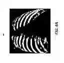 Fig. 09 - Hybrid dual energy imaging and bone suppression processing