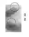 Fig. 12 - Hybrid dual energy imaging and bone suppression processing