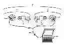 Fig. 01 - Fitting bilateral hearing prostheses