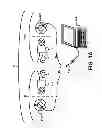 Fig. 02 - Fitting bilateral hearing prostheses
