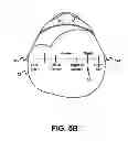 Fig. 07 - Fitting bilateral hearing prostheses
