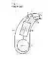 Fig. 02 - Hearing apparatus with a facility for reducing a microphone noise and method for reducing microphone noise