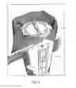 Fig. 09 - Covered housing