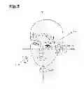 Fig. 06 - Eyelid detection device