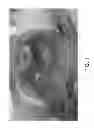 Fig. 02 - Methods and systems for three-dimensional real-time intraoperative surgical margin evaluation of tumor tissues