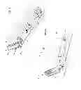 Fig. 10 - Locking ring metal