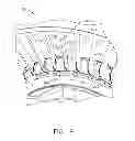 Fig. 07 - Quick engine change assembly for outlet guide vanes