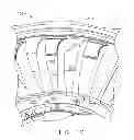 Fig. 08 - Quick engine change assembly for outlet guide vanes