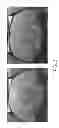 Fig. 03 - Functionalized magnetic nanoparticles and use in imaging amyloid deposits and neurofibrillary tangles