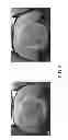 Fig. 04 - Functionalized magnetic nanoparticles and use in imaging amyloid deposits and neurofibrillary tangles