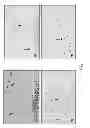 Fig. 06 - Functionalized magnetic nanoparticles and use in imaging amyloid deposits and neurofibrillary tangles