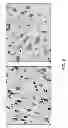Fig. 07 - Functionalized magnetic nanoparticles and use in imaging amyloid deposits and neurofibrillary tangles