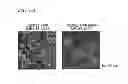 Fig. 07 - Pluripotent stem cell-derived brown adipocytes, pluripotent stem cell-derived cell aggregate, method for producing same, and cell therapy and medical therapy therefor