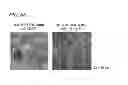 Fig. 08 - Pluripotent stem cell-derived brown adipocytes, pluripotent stem cell-derived cell aggregate, method for producing same, and cell therapy and medical therapy therefor