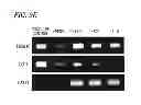 Fig. 17 - Pluripotent stem cell-derived brown adipocytes, pluripotent stem cell-derived cell aggregate, method for producing same, and cell therapy and medical therapy therefor