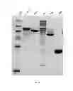 Fig. 06 - Manufacturing and Purification Processes of Complex Protein found in Fraction IV to make a separated Apo, Transferrin, and Alpha 1 Anti strepsin (A1AT) or A combined Transferrin/Apo/Human Albumin/A1AT and all new found proteins