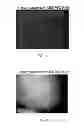 Fig. 16 - Manufacturing and Purification Processes of Complex Protein found in Fraction IV to make a separated Apo, Transferrin, and Alpha 1 Anti strepsin (A1AT) or A combined Transferrin/Apo/Human Albumin/A1AT and all new found proteins