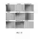 Fig. 28 - Manufacturing and Purification Processes of Complex Protein found in Fraction IV to make a separated Apo, Transferrin, and Alpha 1 Anti strepsin (A1AT) or A combined Transferrin/Apo/Human Albumin/A1AT and all new found proteins