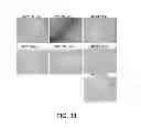 Fig. 29 - Manufacturing and Purification Processes of Complex Protein found in Fraction IV to make a separated Apo, Transferrin, and Alpha 1 Anti strepsin (A1AT) or A combined Transferrin/Apo/Human Albumin/A1AT and all new found proteins