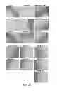 Fig. 33 - Manufacturing and Purification Processes of Complex Protein found in Fraction IV to make a separated Apo, Transferrin, and Alpha 1 Anti strepsin (A1AT) or A combined Transferrin/Apo/Human Albumin/A1AT and all new found proteins