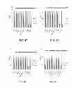 Fig. 44 - Manufacturing and Purification Processes of Complex Protein found in Fraction IV to make a separated Apo, Transferrin, and Alpha 1 Anti strepsin (A1AT) or A combined Transferrin/Apo/Human Albumin/A1AT and all new found proteins