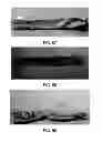 Fig. 49 - Manufacturing and Purification Processes of Complex Protein found in Fraction IV to make a separated Apo, Transferrin, and Alpha 1 Anti strepsin (A1AT) or A combined Transferrin/Apo/Human Albumin/A1AT and all new found proteins