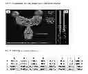 Fig. 02 - CELL-BASED ASSAY FOR ASSESSING TNF ALPHA INHIBITORS