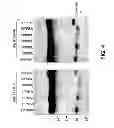 Fig. 07 - Methods of treating disease with FGFR1 fusion proteins
