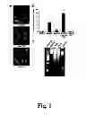 Fig. 02 - METHODS OF DIAGNOSING ATHEROSCLEROSIS BY MEASURING APOCI