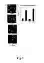 Fig. 03 - METHODS OF DIAGNOSING ATHEROSCLEROSIS BY MEASURING APOCI