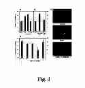 Fig. 05 - METHODS OF DIAGNOSING ATHEROSCLEROSIS BY MEASURING APOCI