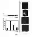 Fig. 06 - METHODS OF DIAGNOSING ATHEROSCLEROSIS BY MEASURING APOCI