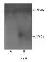 Fig. 11 - METHODS OF DIAGNOSING ATHEROSCLEROSIS BY MEASURING APOCI