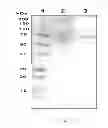 Fig. 05 - TEMPO-mediated glycoconjugation of immunogenic composition against Campylobacter jejuni with improved structural integrity and immunogenicity