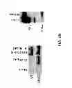 Fig. 08 - CMV glycoproteins and recombinant vectors