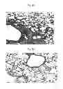 Fig. 12 - Rapid and prolonged immunologic-therapeutic