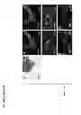 Fig. 06 - Cord Colitis Syndrome Pathogen