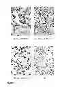 Fig. 04 - Allogeneic tumor cell vaccination